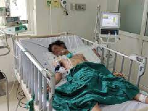 Nguy kịch sau khi vô tình giẫm phải phế liệu